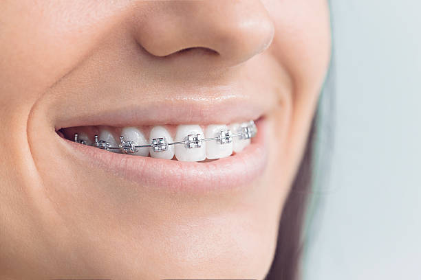 Best Traditional Braces  in Belvedere Park, GA